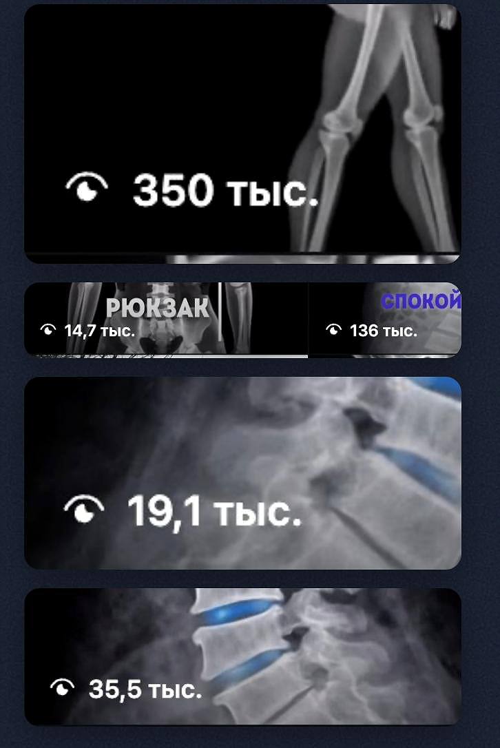 Просмотры публикаций проекта: от 14,7 до 350 тысяч